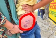 ਪੰਜਾਬ ‘ਚ ਸਰਕਾਰੀ ਅਧਿਆਪਕ ਦਾ ਕਾਰਾ; 5ਵੀਂ ਜਮਾਤ ਦੇ ਬੱਚੇ ਨੂੰ ਬਰੀ ਤਰ੍ਹਾਂ ਕੁੱਟਿਆ